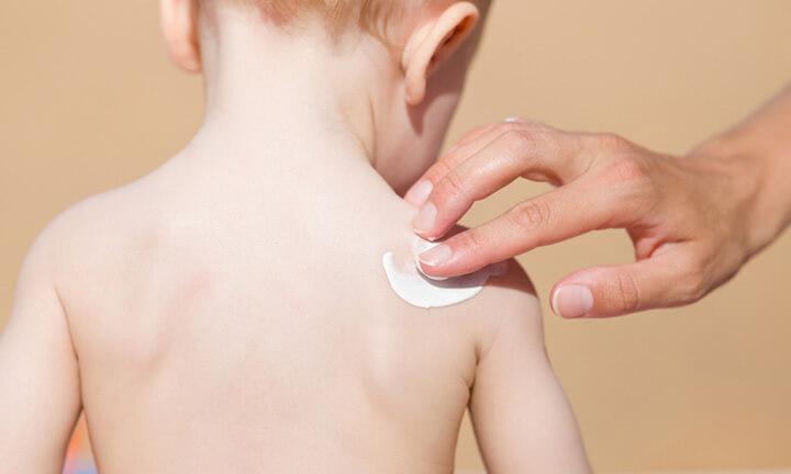 Young mother hand applying sunscreen lotion on baby shoulder. Skin protection. Safety sunbathing in hot day at beach. Back view. Closeup.