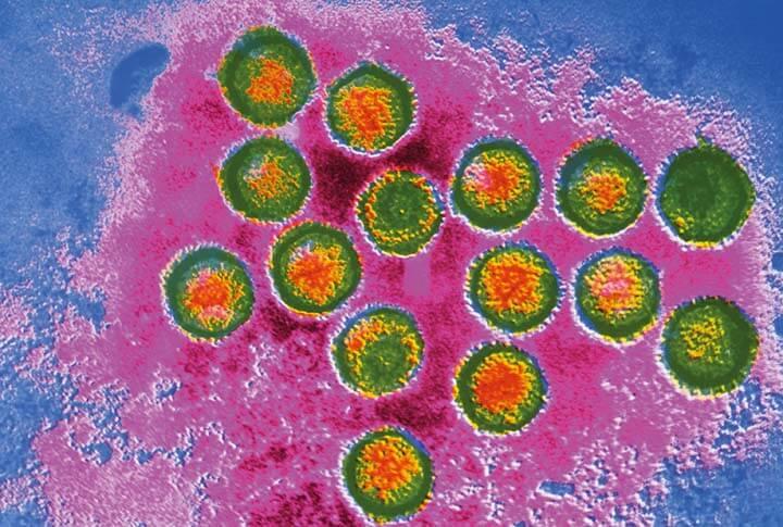 Mikroskopische Aufnahme des Epstein Barr Virus