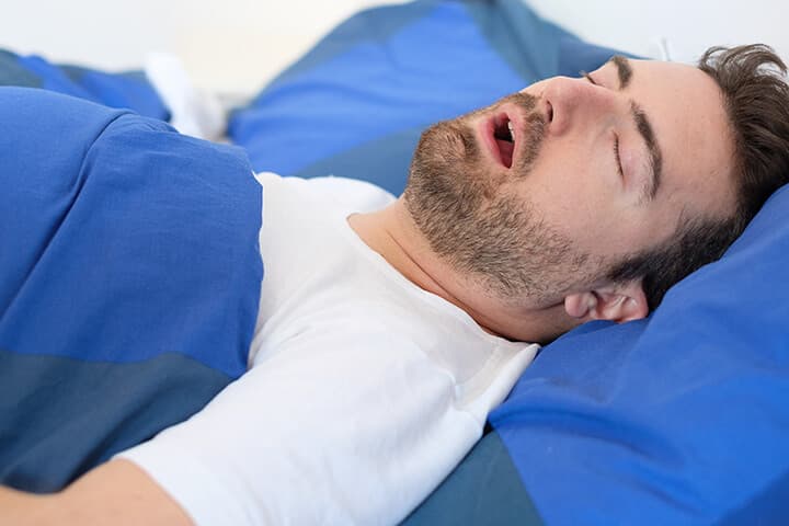 Mann mit Schlafapnoe liegt schlafend im Bett.